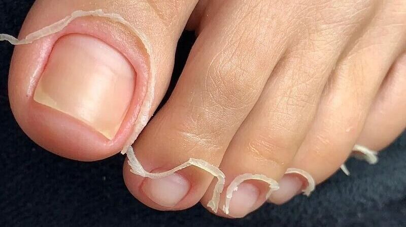 Cuticle Care