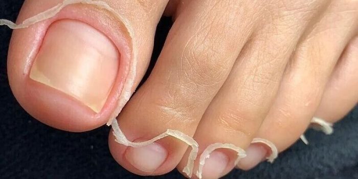 Cuticle Care