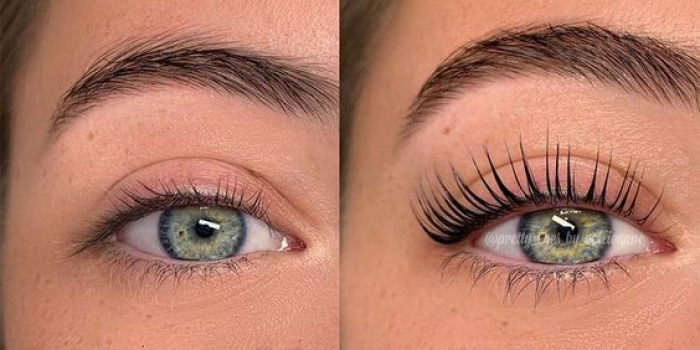 LASH LIFT AND BOTULASH